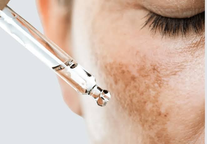 How to Build an Effective Treatment Plan for Skin Pigmentation